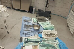 В Одесской области девочка получила серьезную травму от металлических качелей: ей пришлось "собирать" лицо