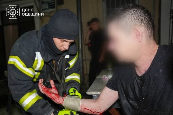 В Приморском районе Одессы горела квартира: пострадал мужчина